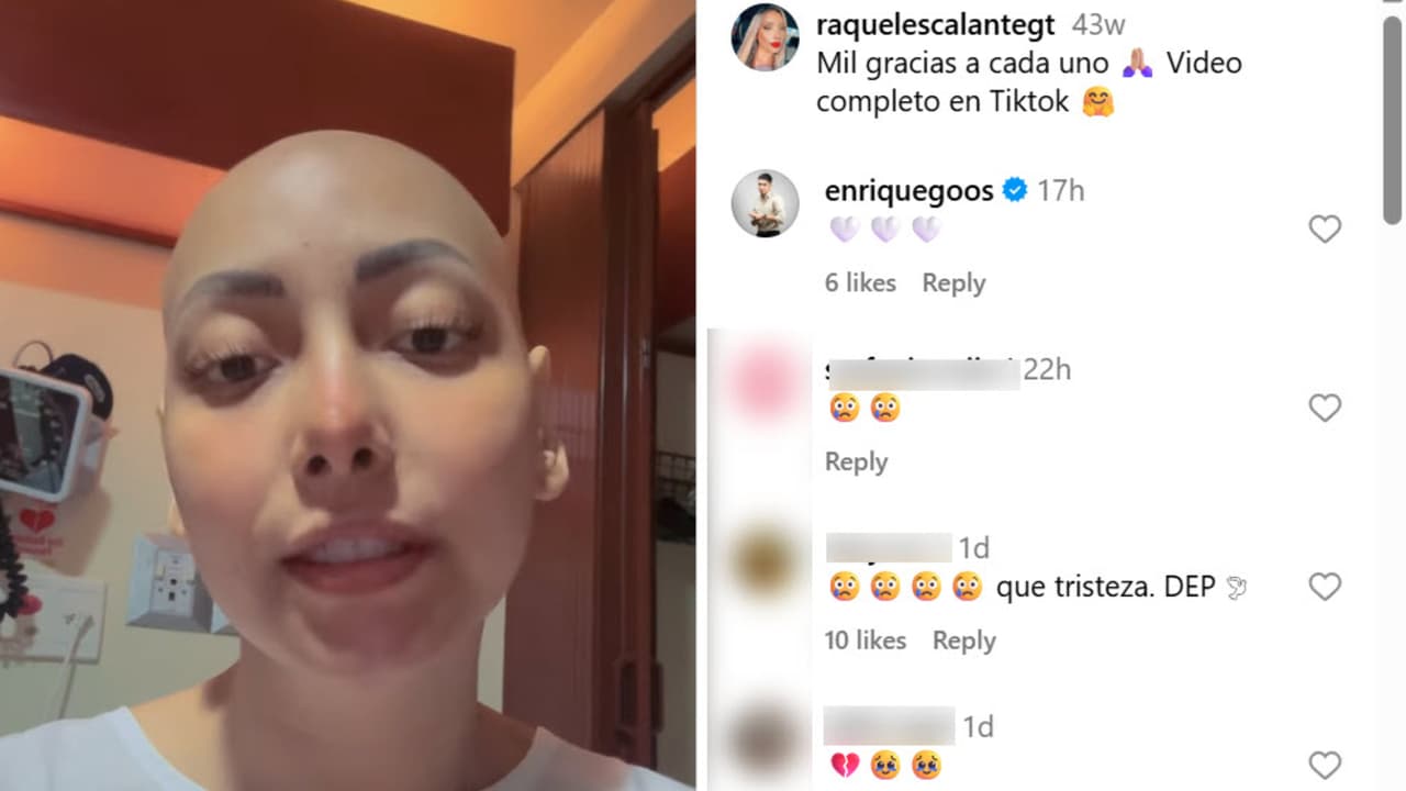 Así se dejó ver Raquel Escalante en Instagram en febrero pasado con las evidentes secuelas del tratamiento contra el cáncer.