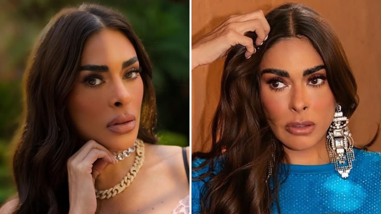 ¿Galilea Montijo tiene parálisis facial?: revela el problema que padece en el rostro tras críticas
