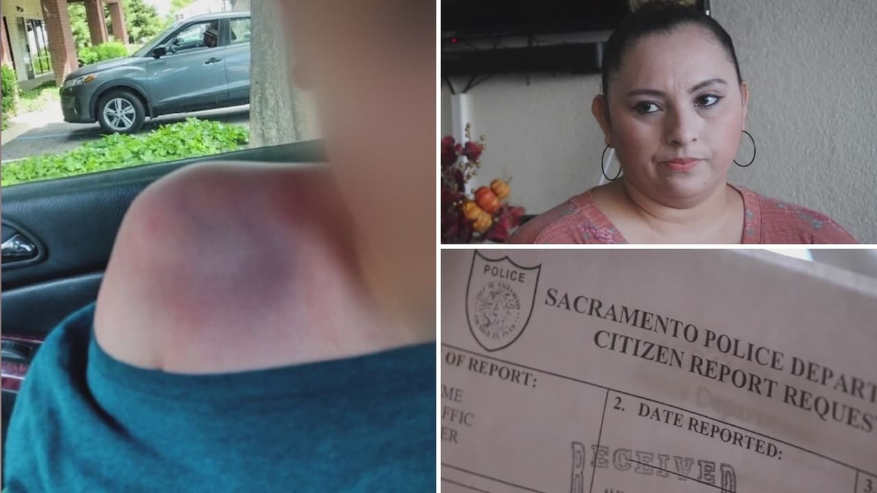 “Lo miré y no pude hacer nada”: madre hispana denuncia a pediatra que golpeó a su hijo de 12 años en una consulta