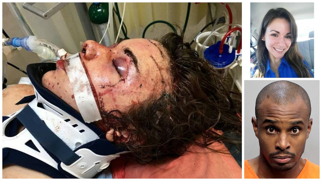 Joven de Miami abre los ojos tras brutal golpiza