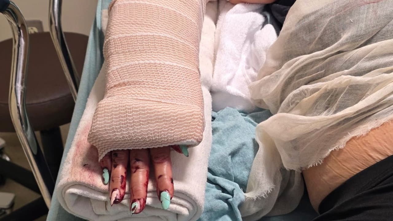 A plena luz del día: ataque con bate deja a niñera hispana herida de gravedad en Sugar Land, Texas
