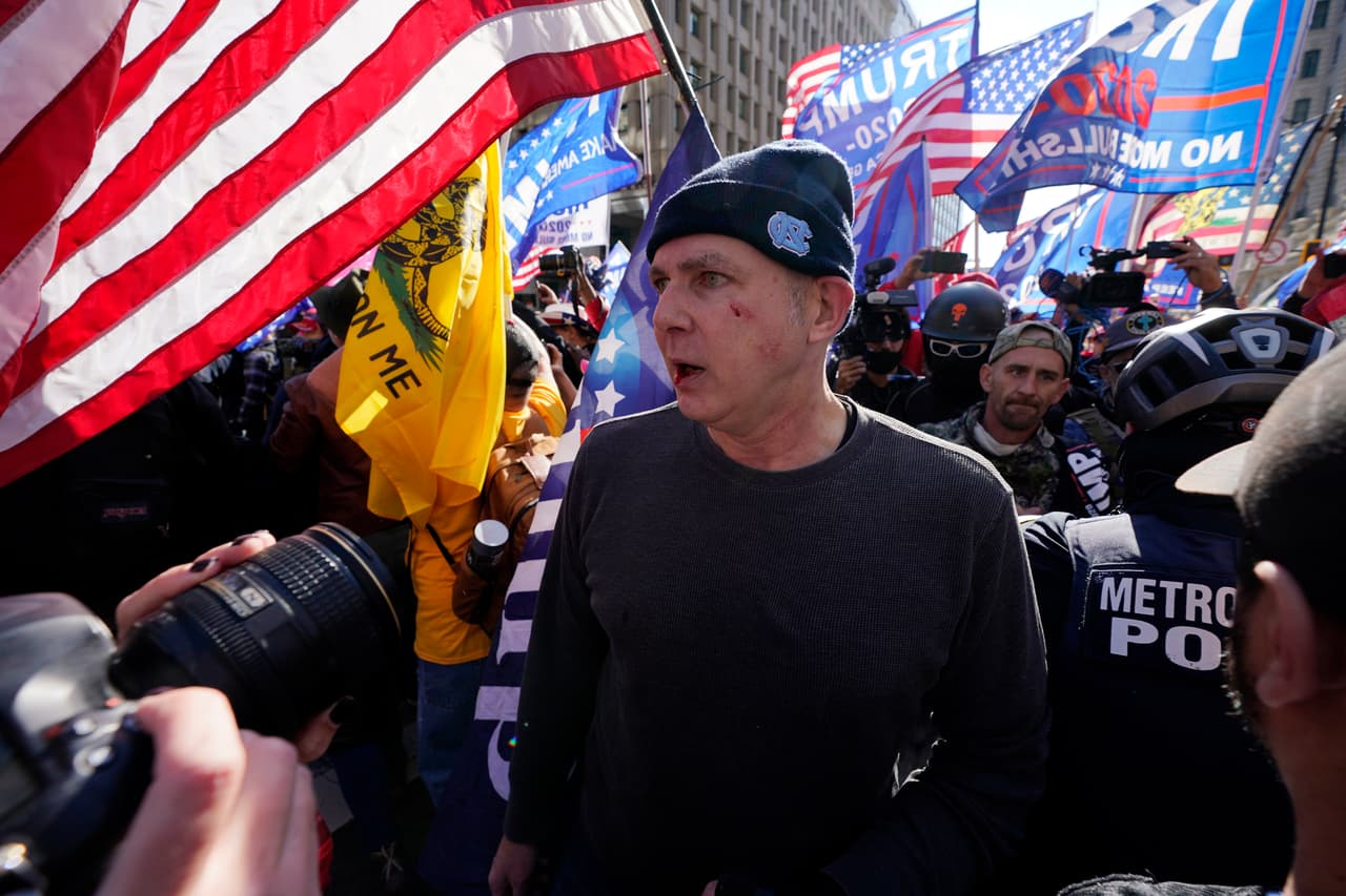 Este hombre se ve con la cara golpeada tras enfrentarse a otro en medio de la protesta a favor de Trump este sábado en Washington DC.