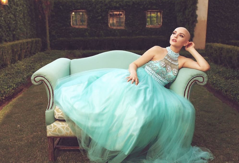 Con esta sesión de fotos, Andrea Sierra Salazar demostró que la belleza no conoce impedimentos