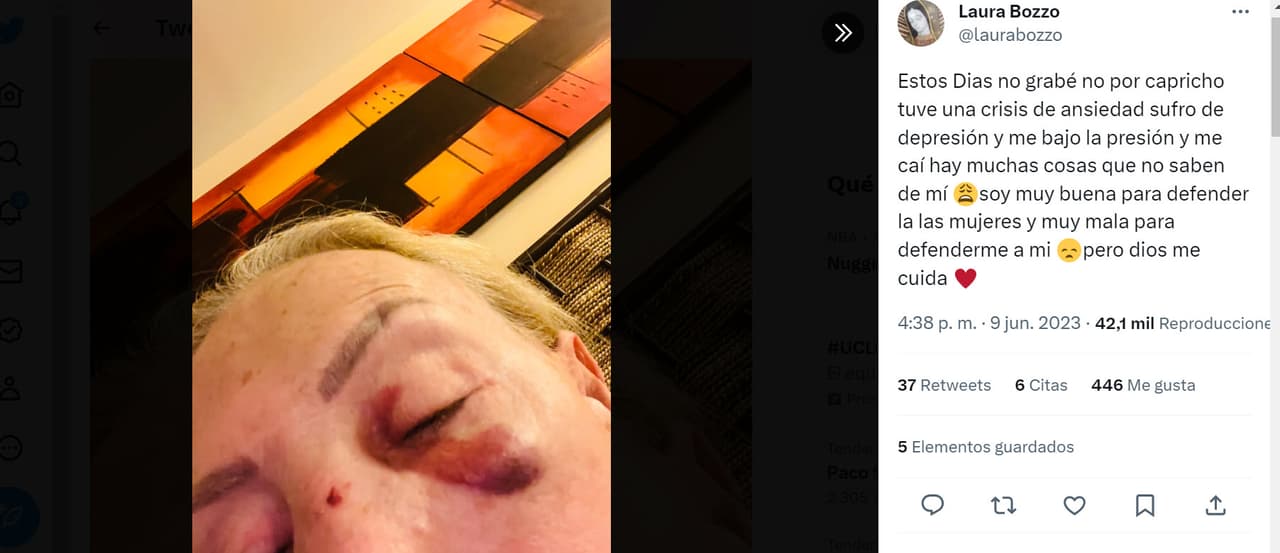 Laura Bozzo sufre accidente tras sufris una crisis de ansiedad.