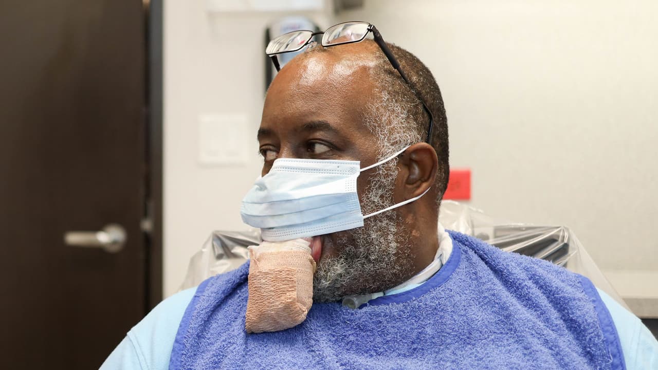 “La lengua les crece como una vaca”: descubren rara condición en pacientes con coronavirus