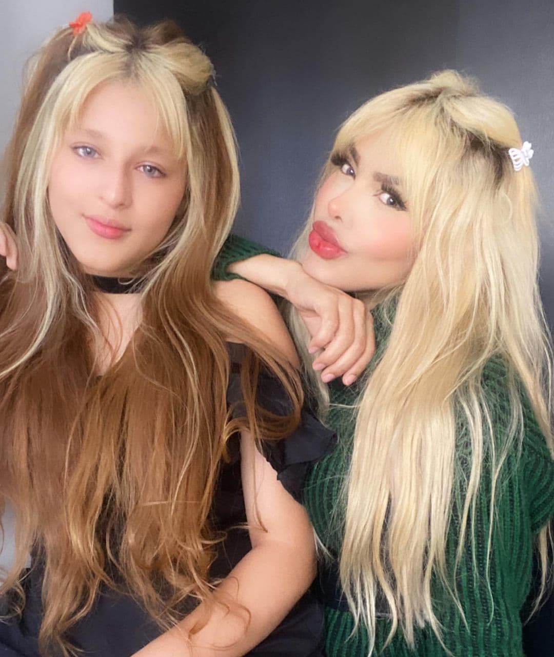 Hace poco, también había llamado la atención de los medios por haber informado que a su hija de 12 años le regaló de cumpleaños su primera cirugía estética, una rinoplastia.