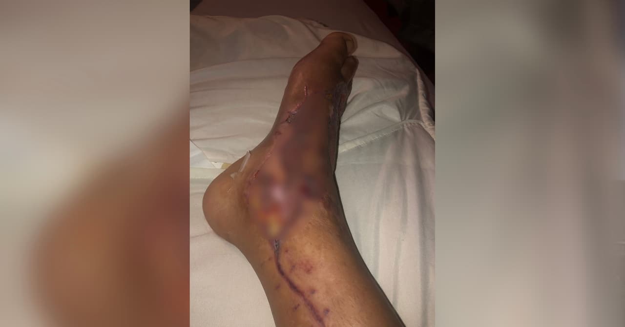 La
<b><a href="https://www.univision.com/local/houston-kxln/lou-huerta-bacteria-come-carne-houston-fotos-1">madre de cuatro</a></b> asegura que después de ser dada de alta del hospital continúa luchando contra los efectos de la bacteria ‘come carne’, agregó que cuenta con el apoyo de su familia.