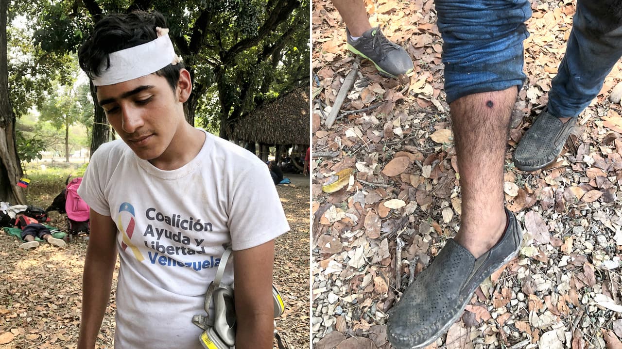 Eimar Aponte, de 18 años, es uno de los heridos que está en el campamento de Tienditas. Llegó desde San Cristóbal, acompañó a los camiones de ayuda y recibió dos perdigonazos en la cabeza y la pierna. "Si no hubiera sido por la policía de Colombia, habría muchos muertos", asegura.