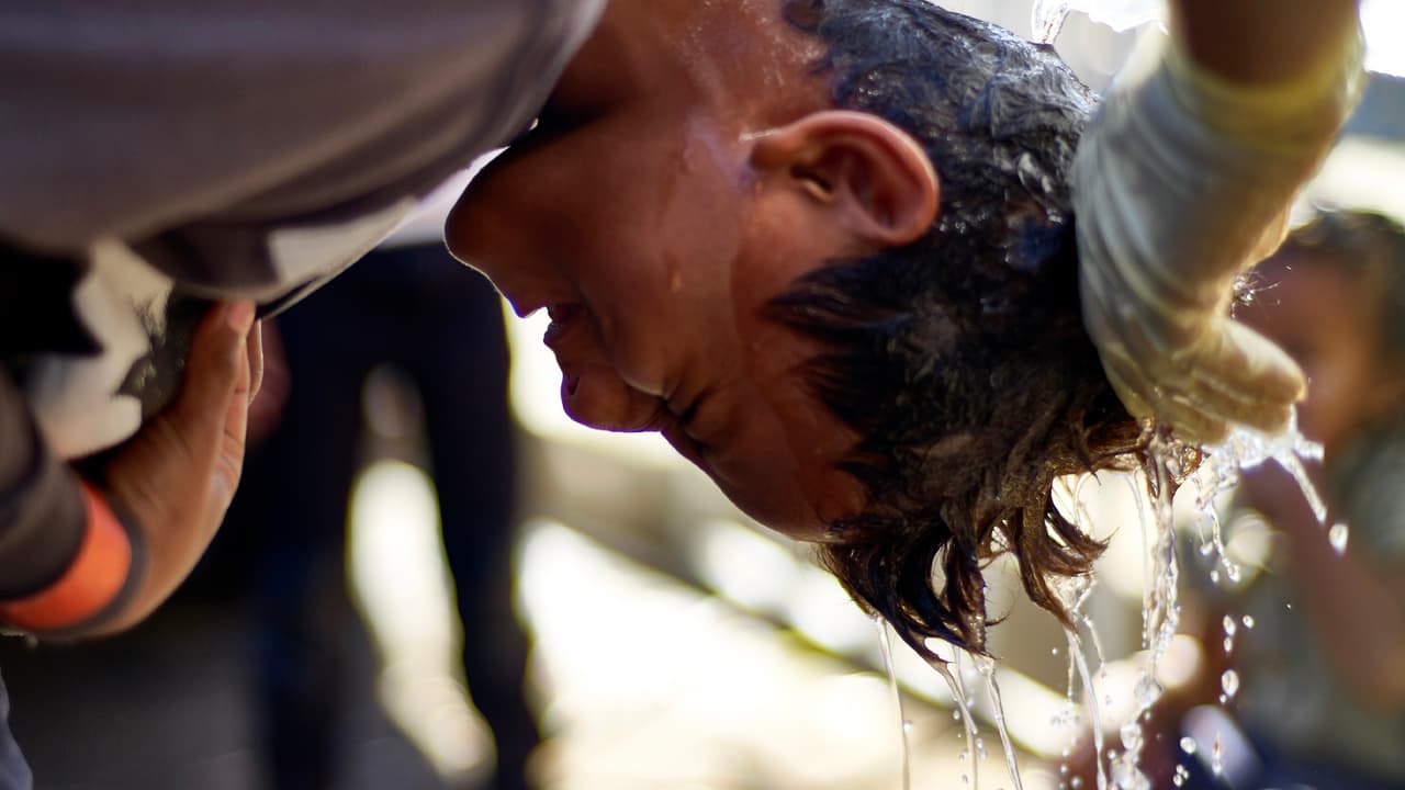 “Afortunadamente los piojos no transmiten ninguna enfermedad por lo que no se consideran transmisores de alguna epidemia y menos que puedan provocar una pandemia, pero sí son muy desagradables y molestos”, indicó el Dr. Yudovich.