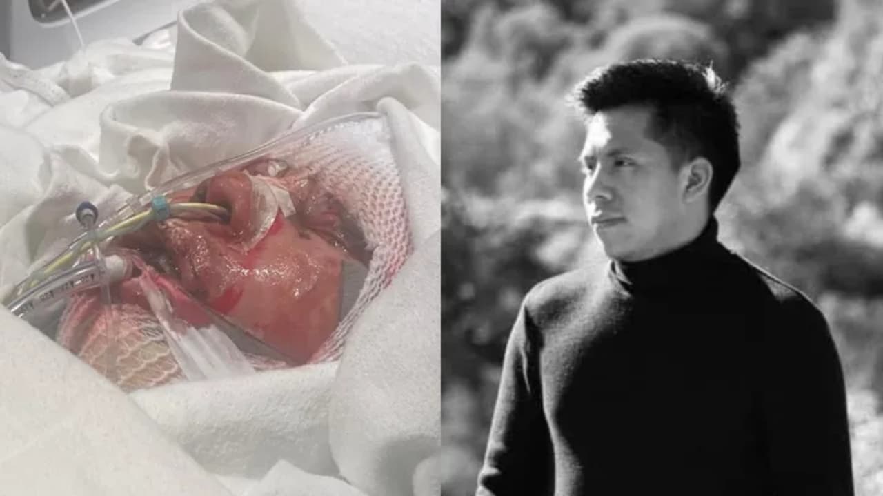 Guatemalteco sufre quemaduras graves cuando una avioneta impactó su taller de trabajo en Fullerton