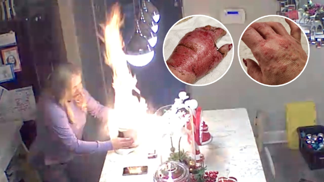 Texana alega que una vela aromática le explotó en las manos y busca millonaria compensación