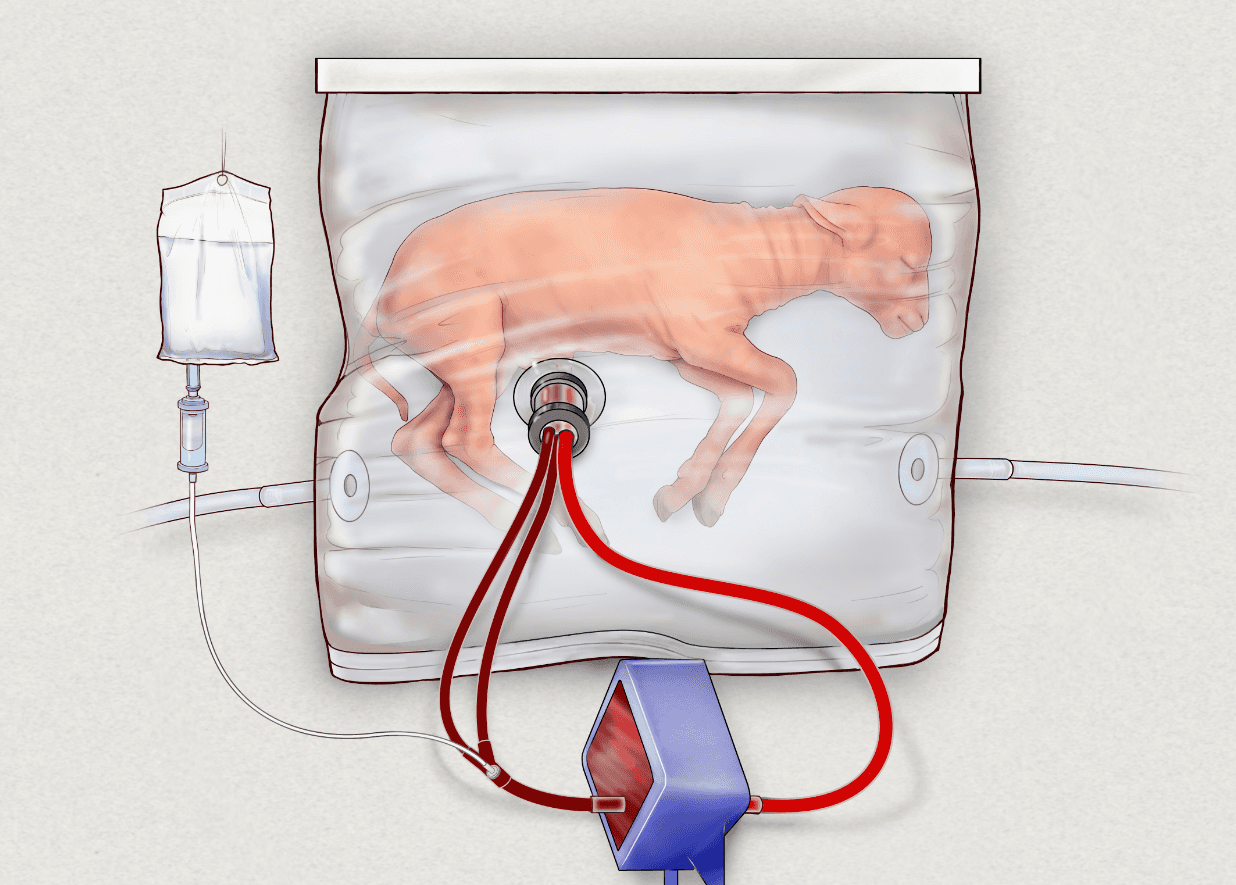 El dispositivo no tiene bomba externa para impulsar la circulación porque incluso la más suave presión artificial puede sobrecargar fatalmente a un corazón en desarrollo; y tampoco hay ventilador porque los pulmones inmaduros no están preparados para respirar todavía.