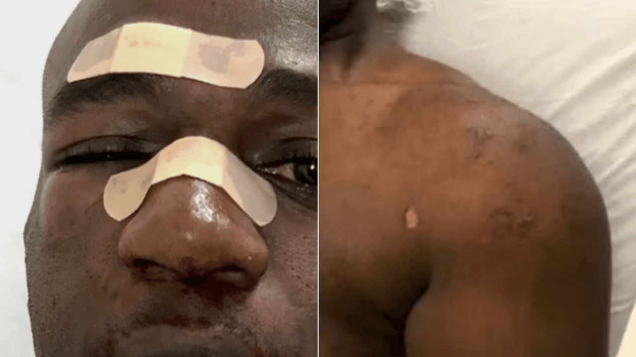 Le arrojó agua caliente y lo golpeó hasta romperle la nariz, así fue el ataque de un preso a un agente