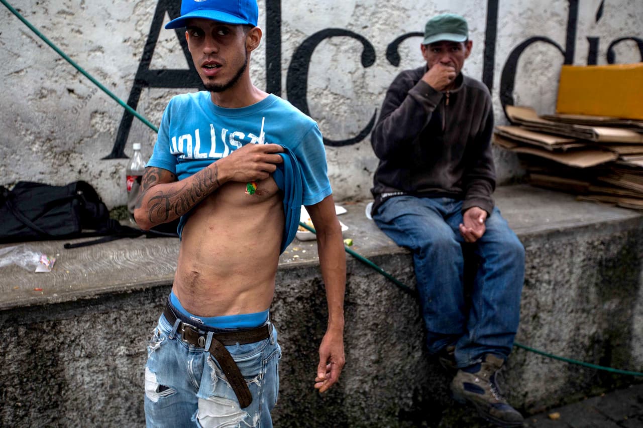 Carlos Arévalo duerme desde hace tres años en la calle y cuando tiene dinero paga "una pensión de mala muerte" en el centro de Caracas. "Y mira lo que se me pegó a mí por estar durmiendo en pensiones.
<b>Esto es escabiosis, sarna, y no hay medicinas"</b>, dice Arévalo, levantándose la camisa. Vivía con su madre en el barrio caraqueño de Pinto Salinas. Ella murió de cáncer. Él cayó en las drogas y acabó en la calle. Su único hermano se fue del país hace dos años y vive en Estados Unidos. "No tuvo mucho problema para irse porque tiene la nacionalidad española. Yo también la tengo, pero también tengo la mala vida. Por situaciones, por problemas personales".