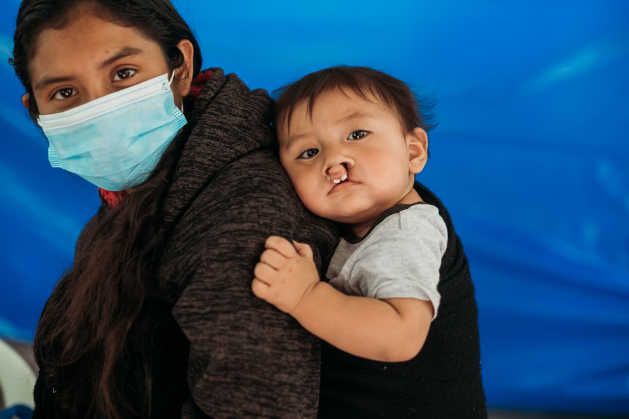 Según la organización, las familias necesitadas viajan desde áreas remotas para llegar hasta los cirujanos texanos.