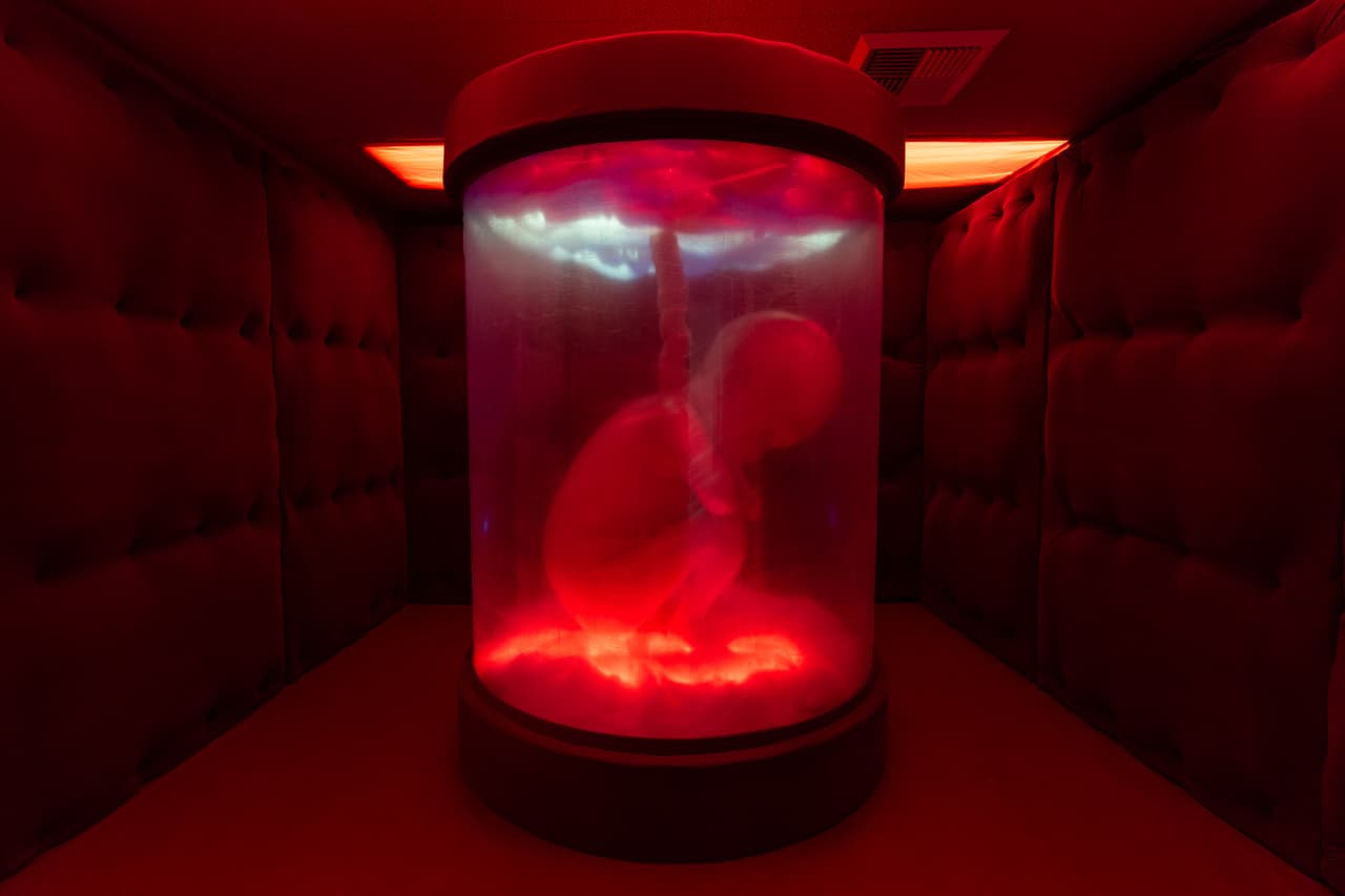 Una figura fetal se exhibe en una instalación del artista Jonathan Elkies en el Departamento de Resiliencia durante la exposición "Hospital de las Emociones" dentro de un antiguo edificio hospitalario en Los Ángeles, el miércoles 22 de julio de 2026. (Foto AP/Jae C. Hong)