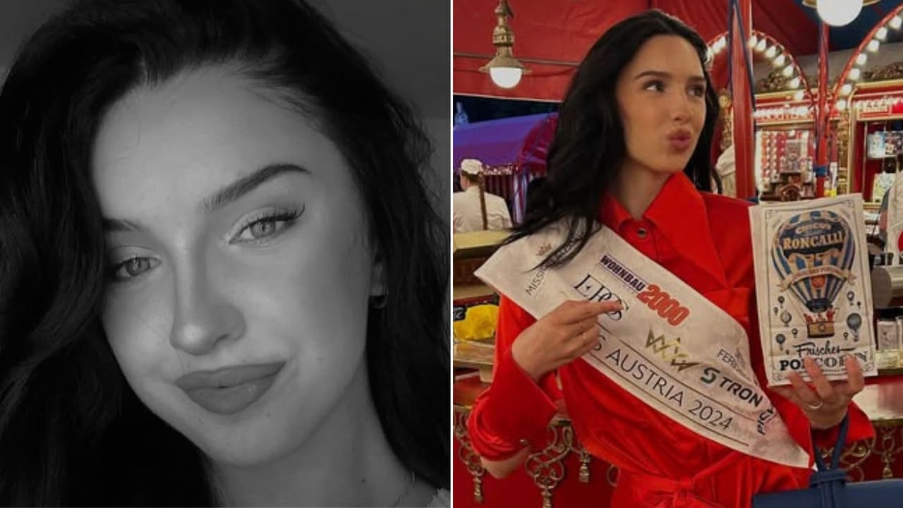 Miss Austria pierde la vida a los 22 años tras someterse a siete cirugías