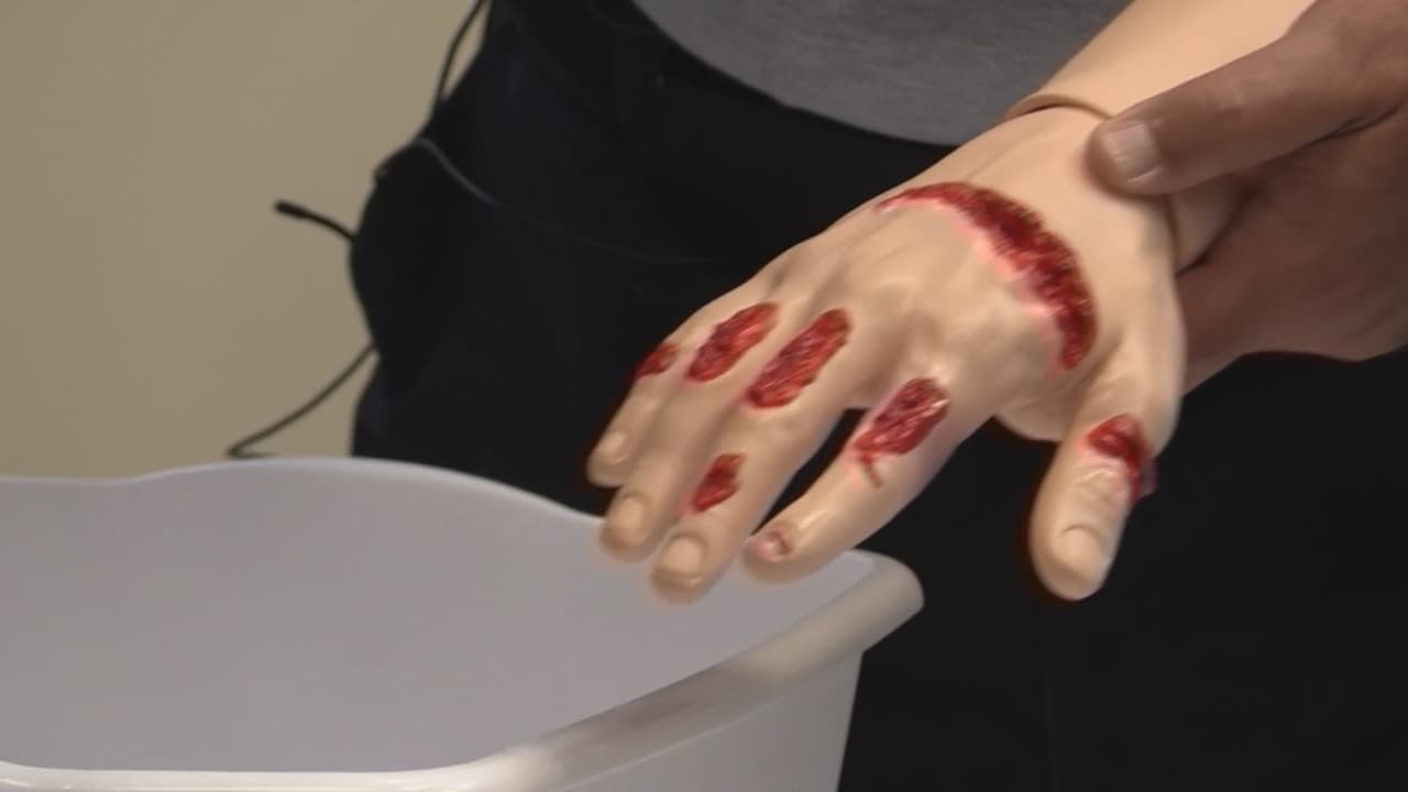 Otro de los “accidentes” comunes a los que se enfrentan los paramédicos en esta época son las alergias. Por esto, recomiendan a quienes preparen la cena que pidan a sus invitados y familiares que los notifiquen si son alérgicos a alguna comida, también tener a la mano antihistamínicos y epinefrina.