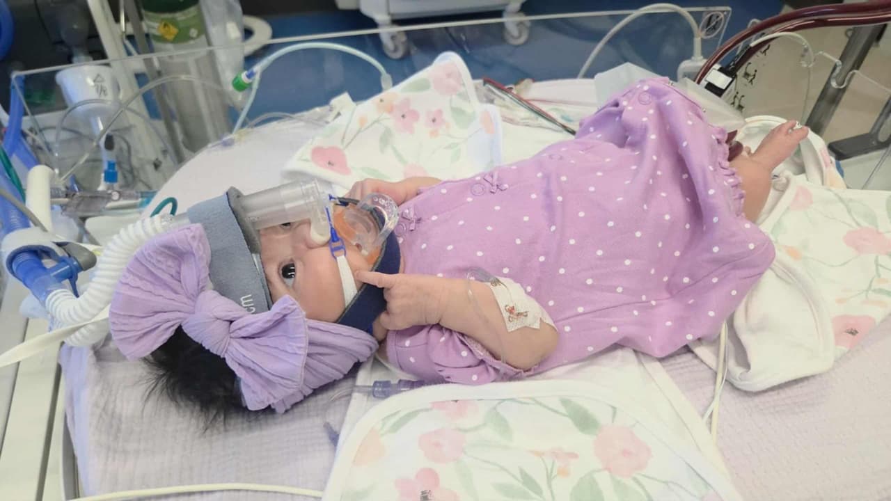 <h3 class="cms-H3-H3">Una bebé sostenida por máquinas</h3> A la semana de nacida, Sarah sufrió un evento crítico:
<b>los estudios revelaron que necesitaba un trasplante.</b>
<br>Children’s Health es el único hospital en el norte de Texas que realiza trasplantes de corazón para niños y
<b>atiende casos tan complejos en pacientes tan pequeños</b>, según la institución.
<br>Mientras llegaba un corazón,
<b> los médicos instalaron un dispositivo de asistencia ventricular .</b>“Toman la función de todo el corazón y
<b>la niña era 100% dependiente de esta máquina</b>”, detalla la doctora Báez Hernández.