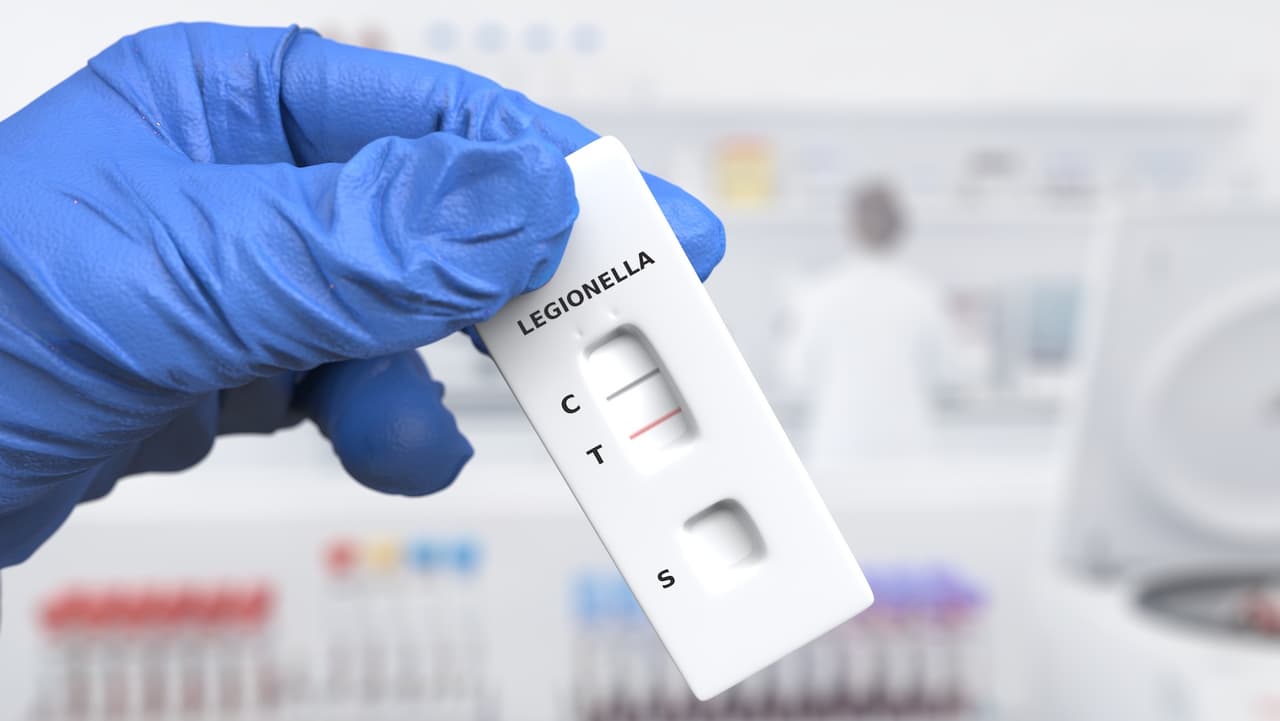 Legionelosis en Nueva York: ya son 14 casos en el Upper East Side; investigan origen de la bacteria