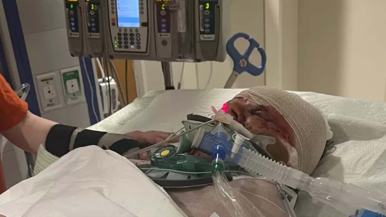 Madre de 3 hijos pierde ambos brazos al ser atacada por varios perros en Carolina del Sur