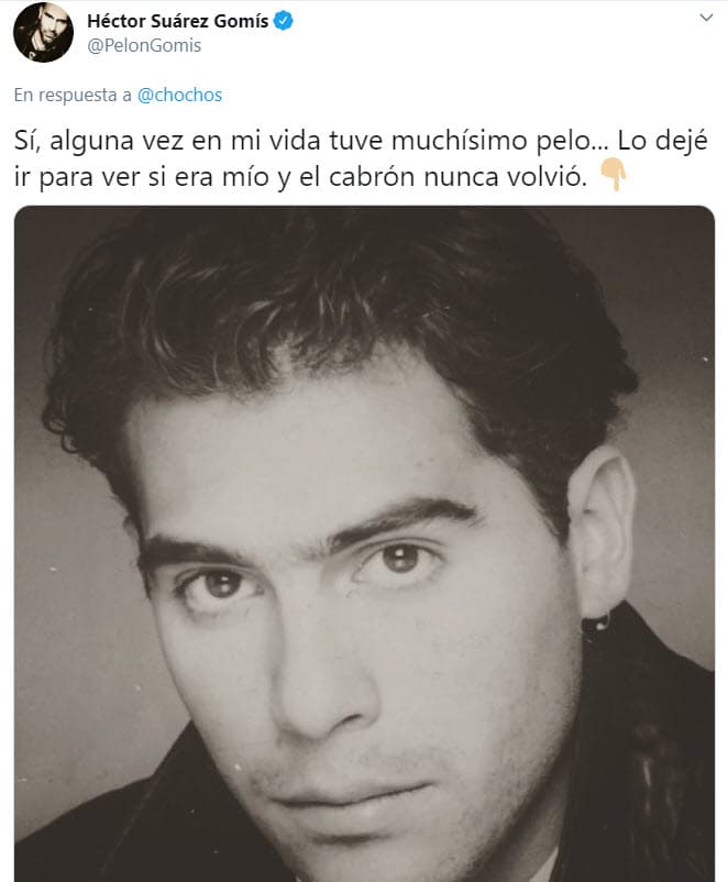 Suárez Gomís decidió
<b>someterse a un tratamiento en Estados Unidos</b> para recuperar su cabellera: "En ese entonces no existían los injertos de hoy, fui a la clínica más seria que había en ese momento, te estoy hablando de principios de los 90, estaba en Beverly Hills".