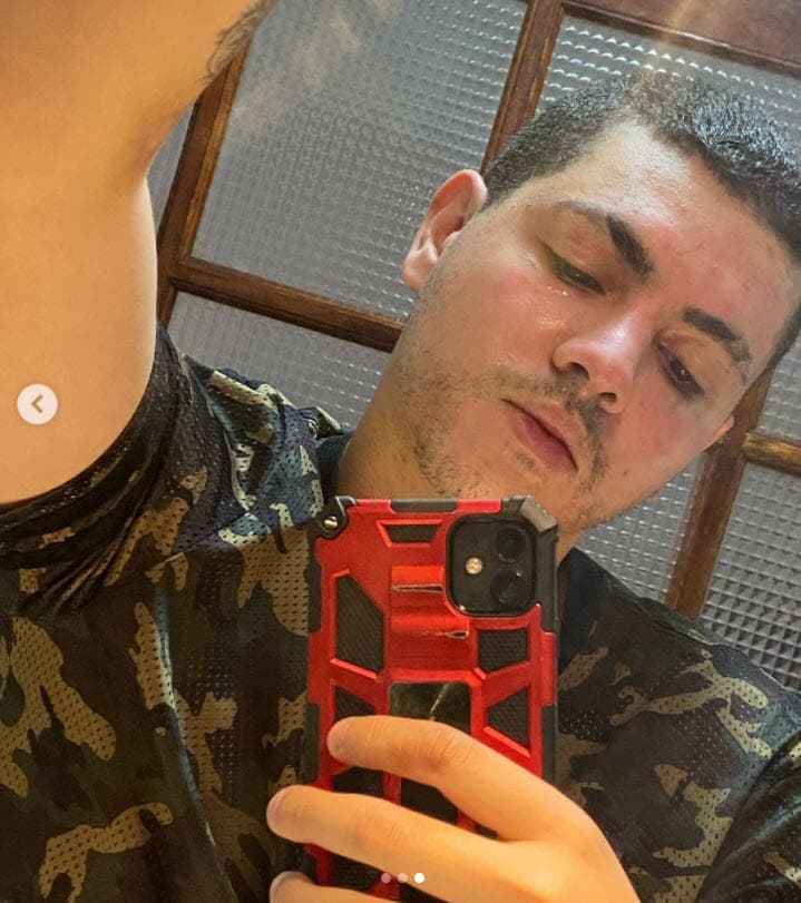 El cantante reconoció que tuvo "miedo de no saber
<b>cómo iba a quedar</b>" tras lo sucedido ya que vive de su imagen: "No saber si iba a poder llevar comida a casa… ¡eso fue lo más difícil!".
<br>