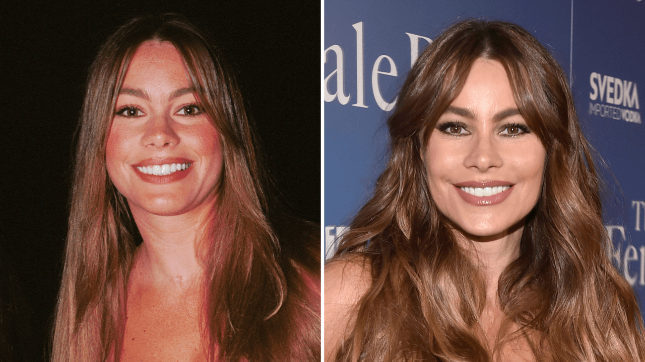 Sofía Vergara mostró la cicatriz que le dejó el cáncer: recordó cómo vivió la enfermedad