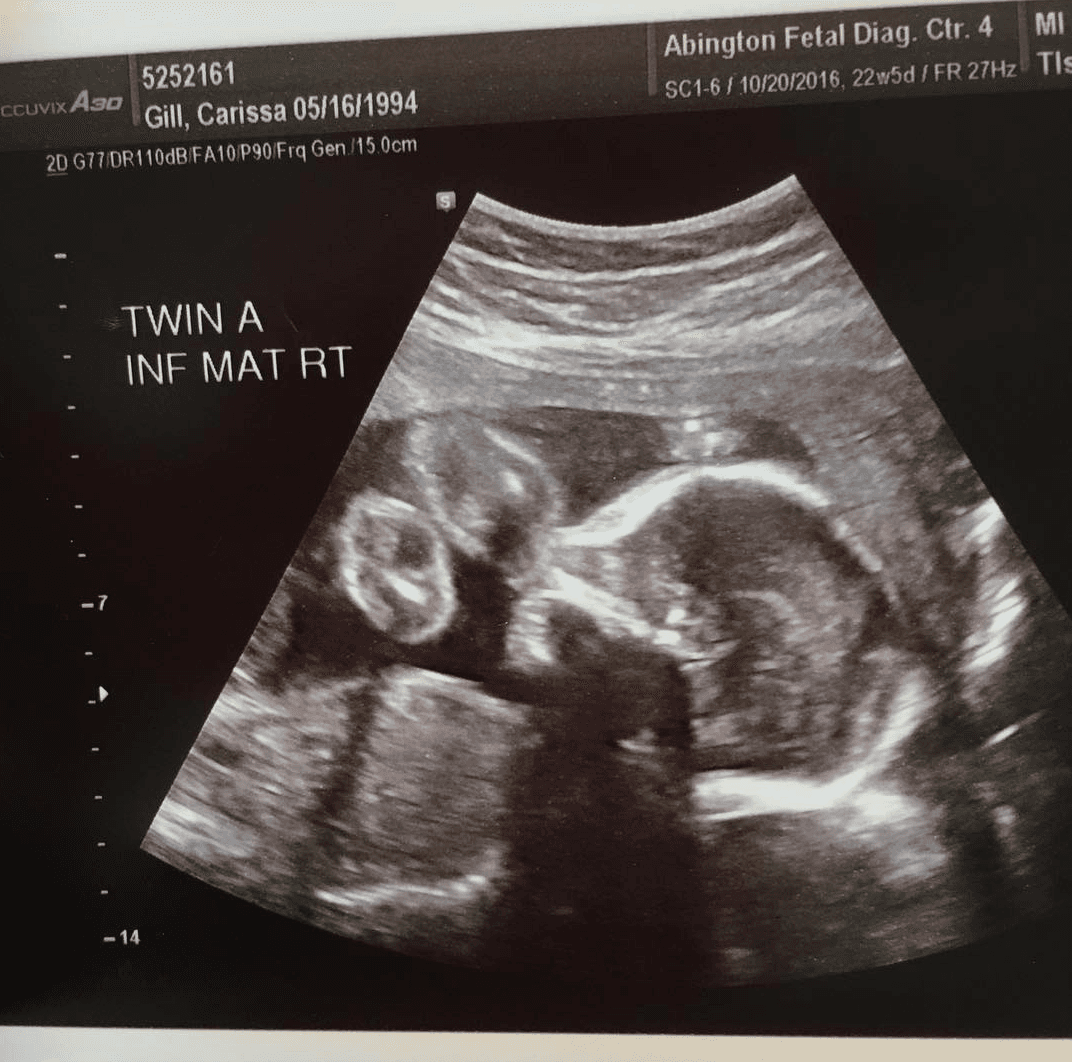 Luego, en esta, la feliz mamá se dio cuenta que una melliza le había puesto su pie en la cara a la otra. "Amo esta experiencia", comentó en su cuenta de Instagram.