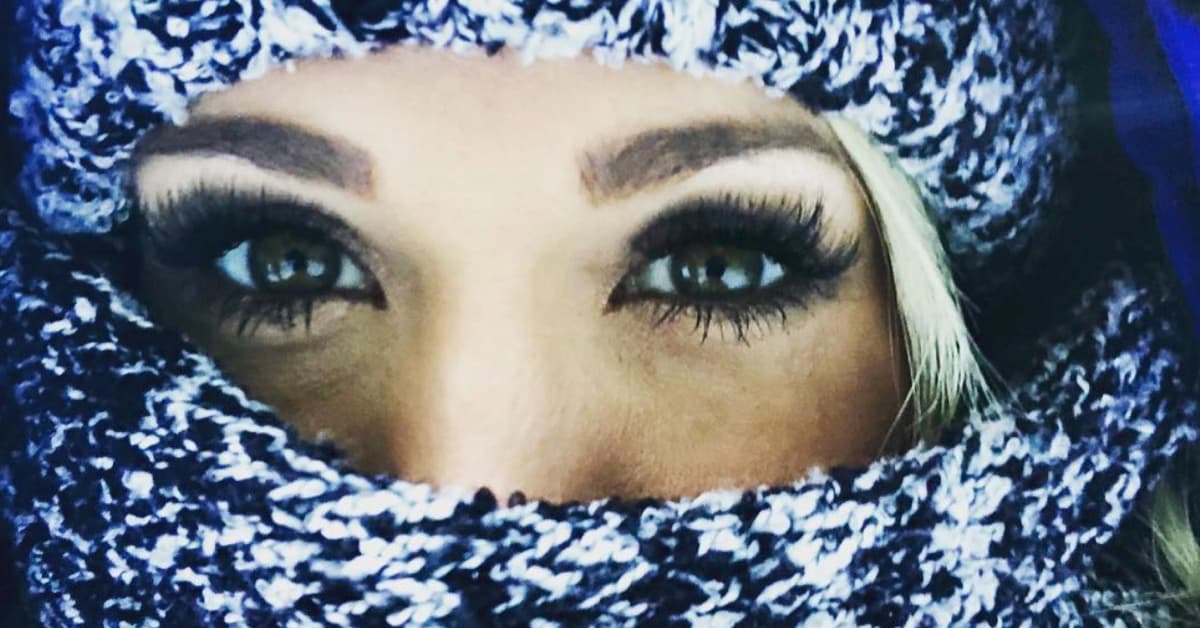 Carrie Underwood anticipa que después de un accidente (y 40 puntos en la cara) no será la misma