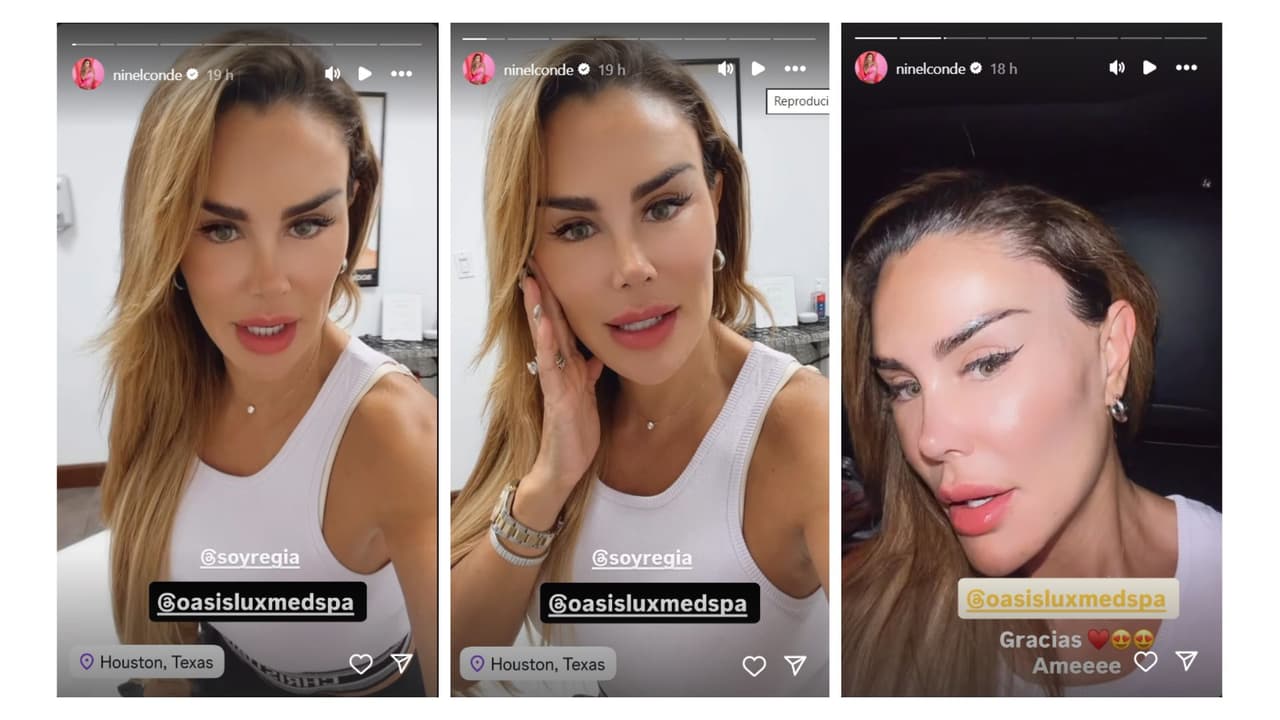 Ninel Conde se somete a nuevo tratamiento de belleza para rejuvenecer su rostro.