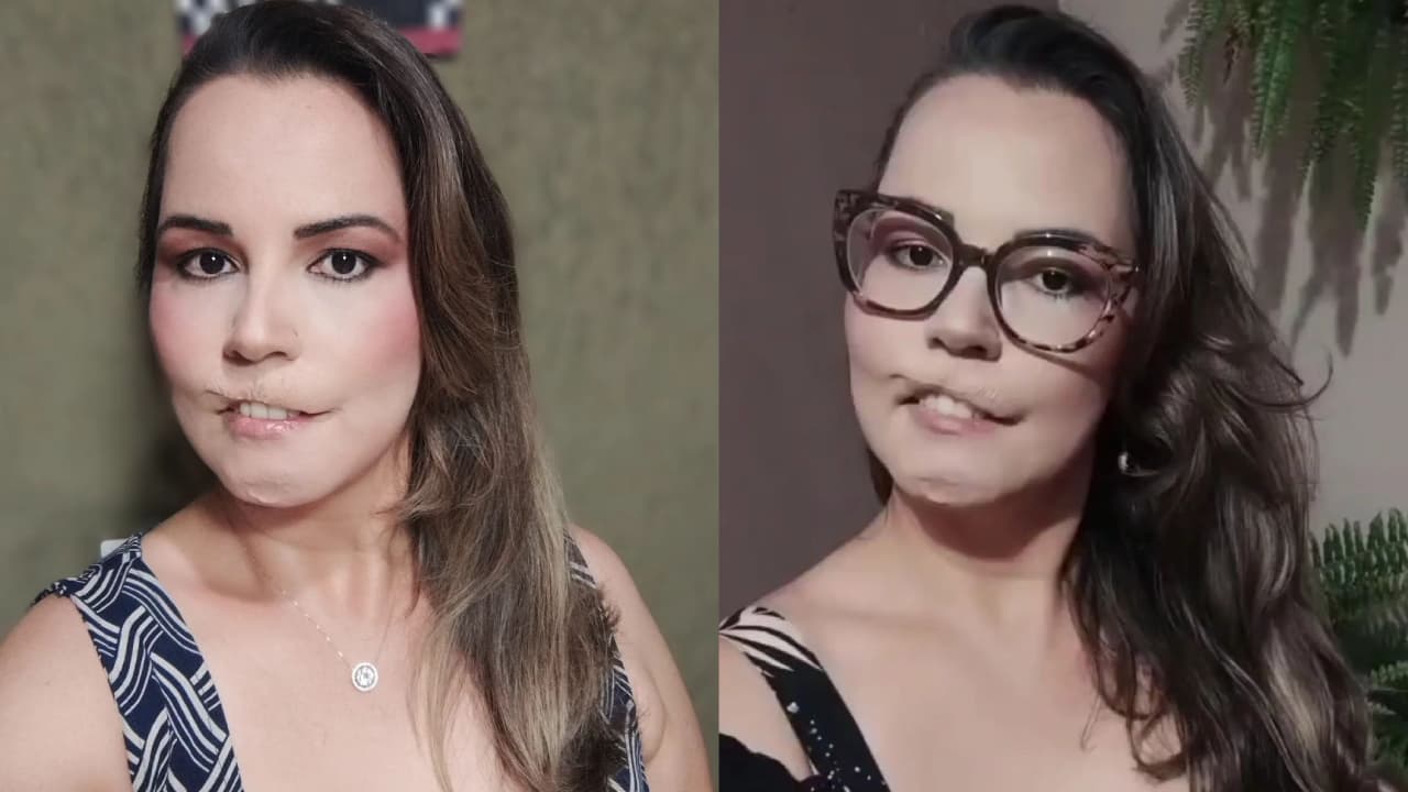 Mariana Michelini, influencer brasileña, quedó irreconocible tras tratamiento estético