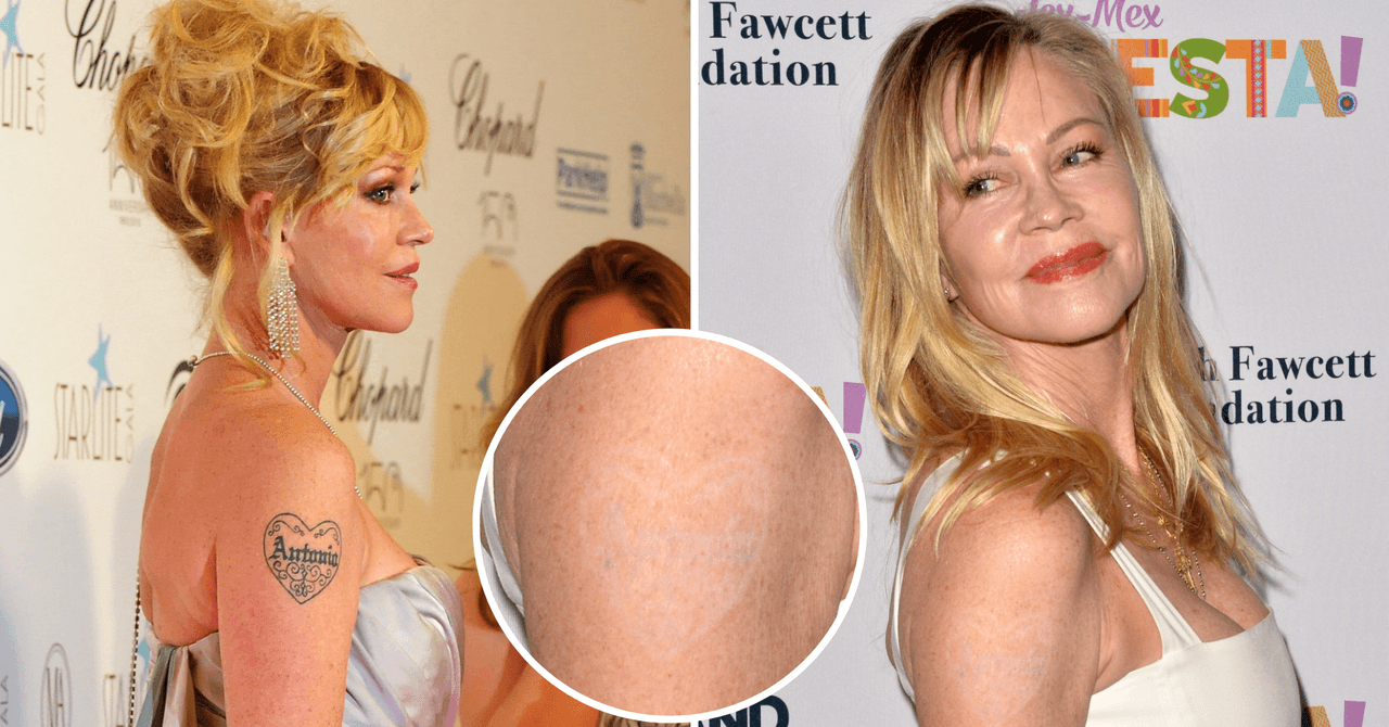 Melanie Griffith borró su tatuaje en honor a Antonio Banderas