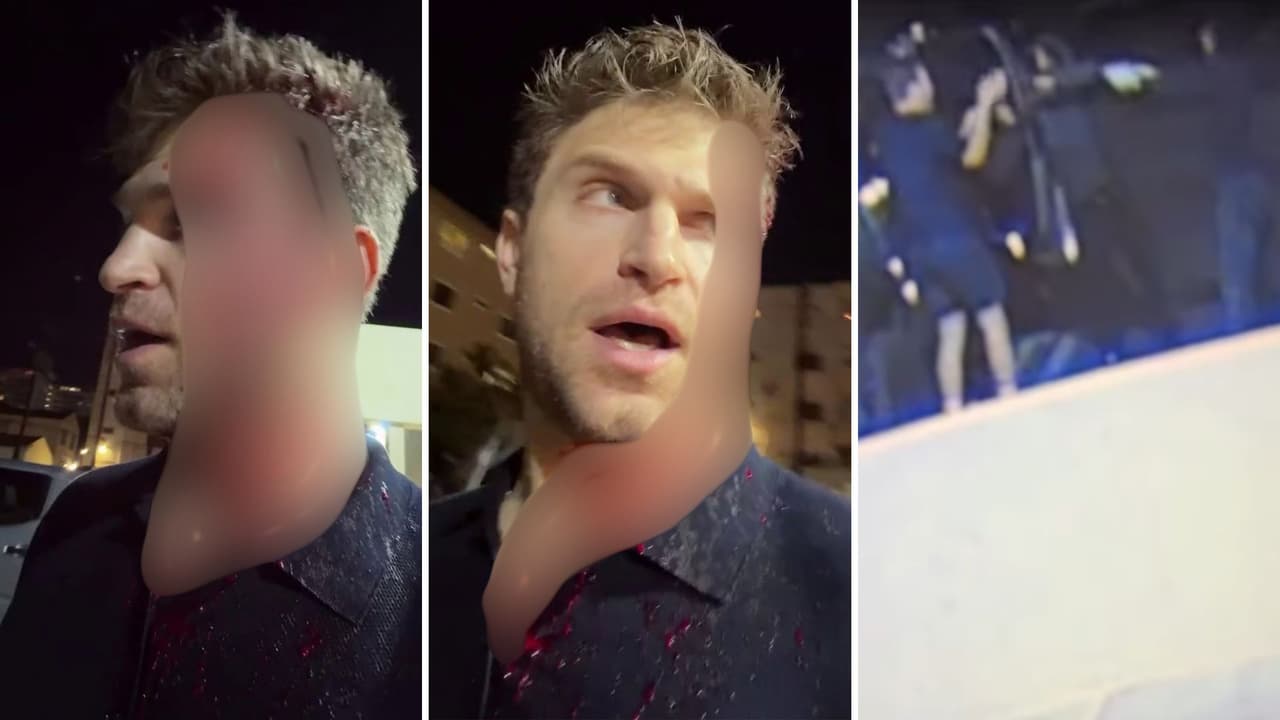 Keegan Allen compartió videos tras haber sido asaltado.