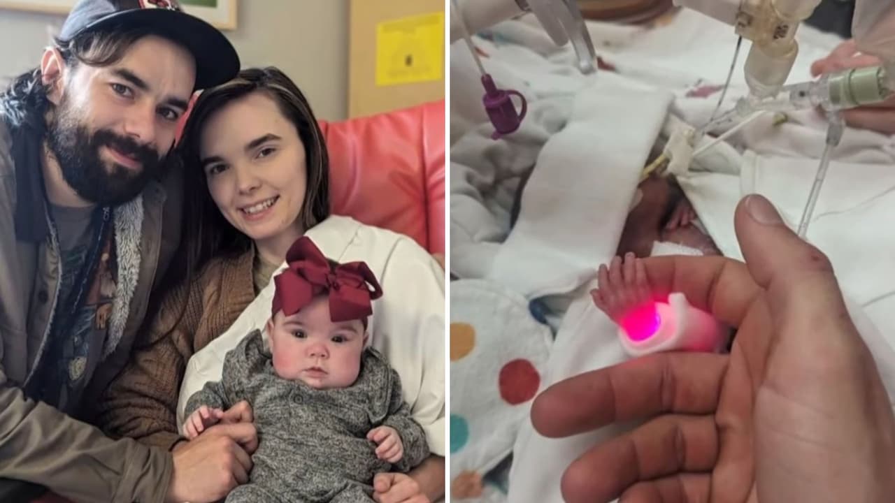 Bebé nace a los 5 meses de gestación y su historia se hace viral.