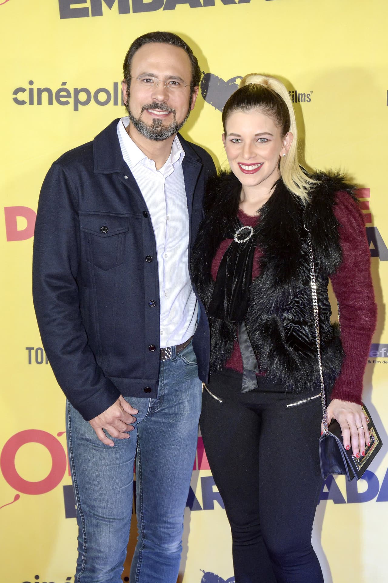 Aunque su autoestima no bajó, tuvo que soportar las bromas y comentarios de sus amigos. Sin embargo, su decisión para recuperar su cabellera se debió a su trabajo en la actuación: "
<b>Como actor necesitas alargar un poco la juventud para conseguir más proyectos</b>".
<br>