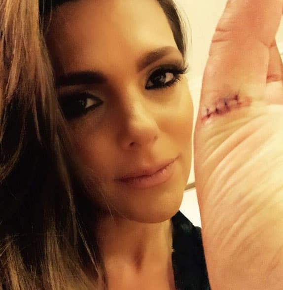 La presentadora se cortó el dedo y tuvo que recibir varios puntos de sutura.