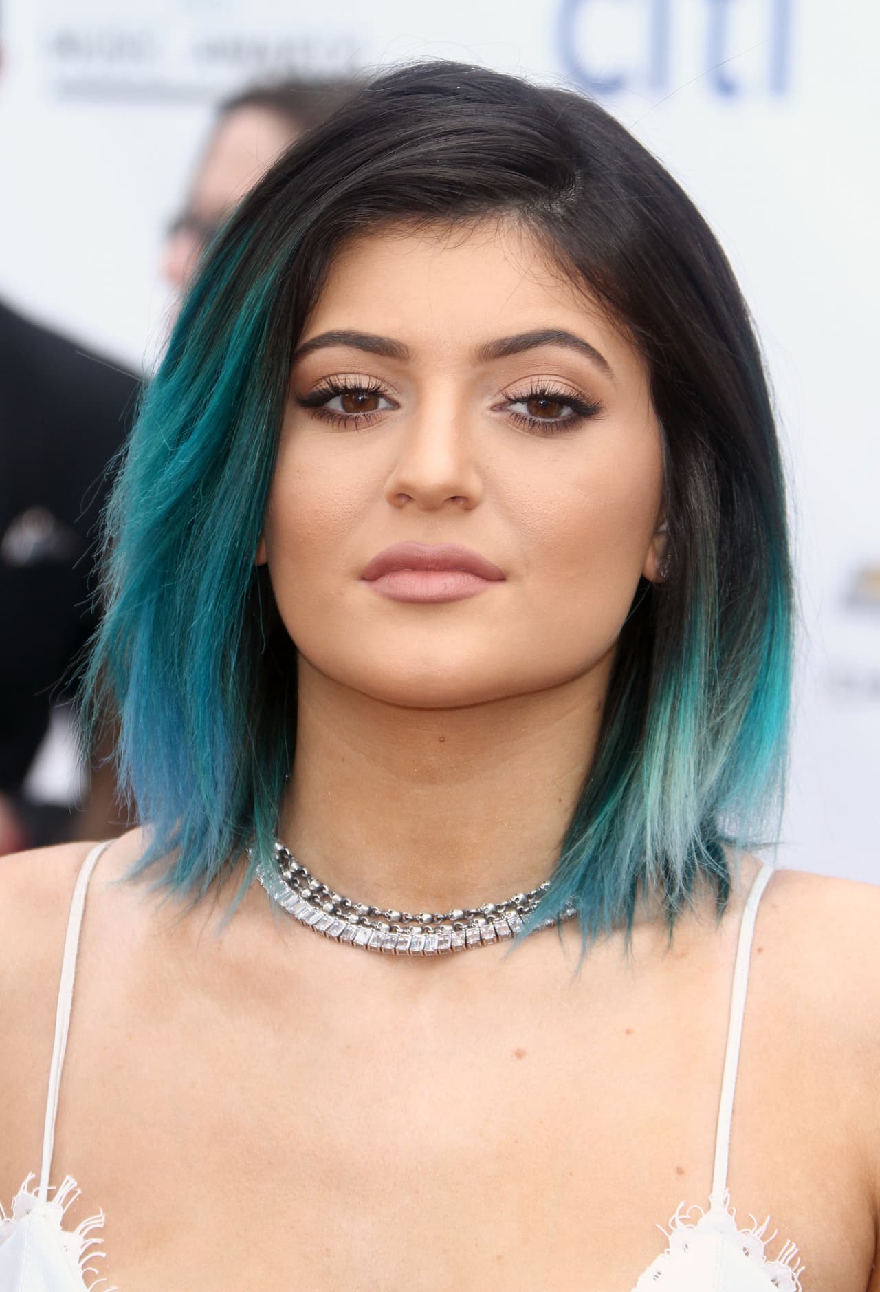 Así que comenzó a inyectarlos para darle volumen.