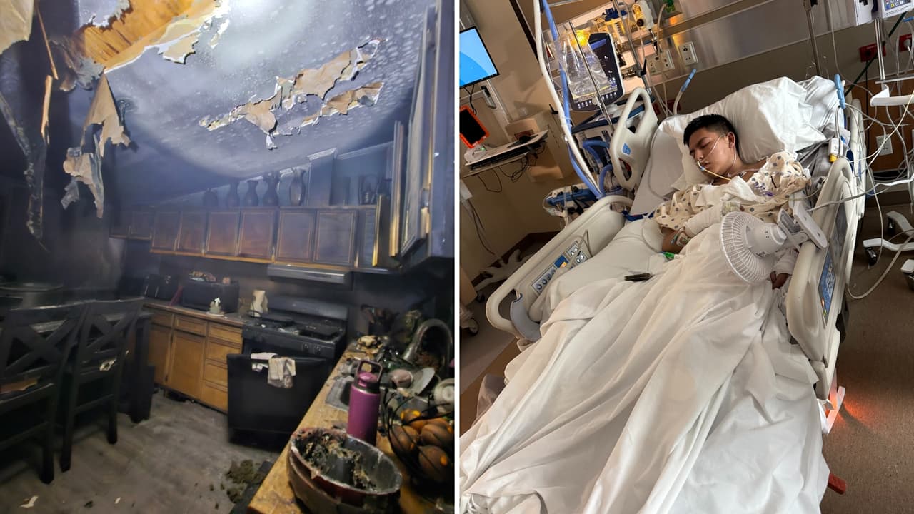 Joven de Austin está en cuidados intensivos tras incendio que destruyó su casa