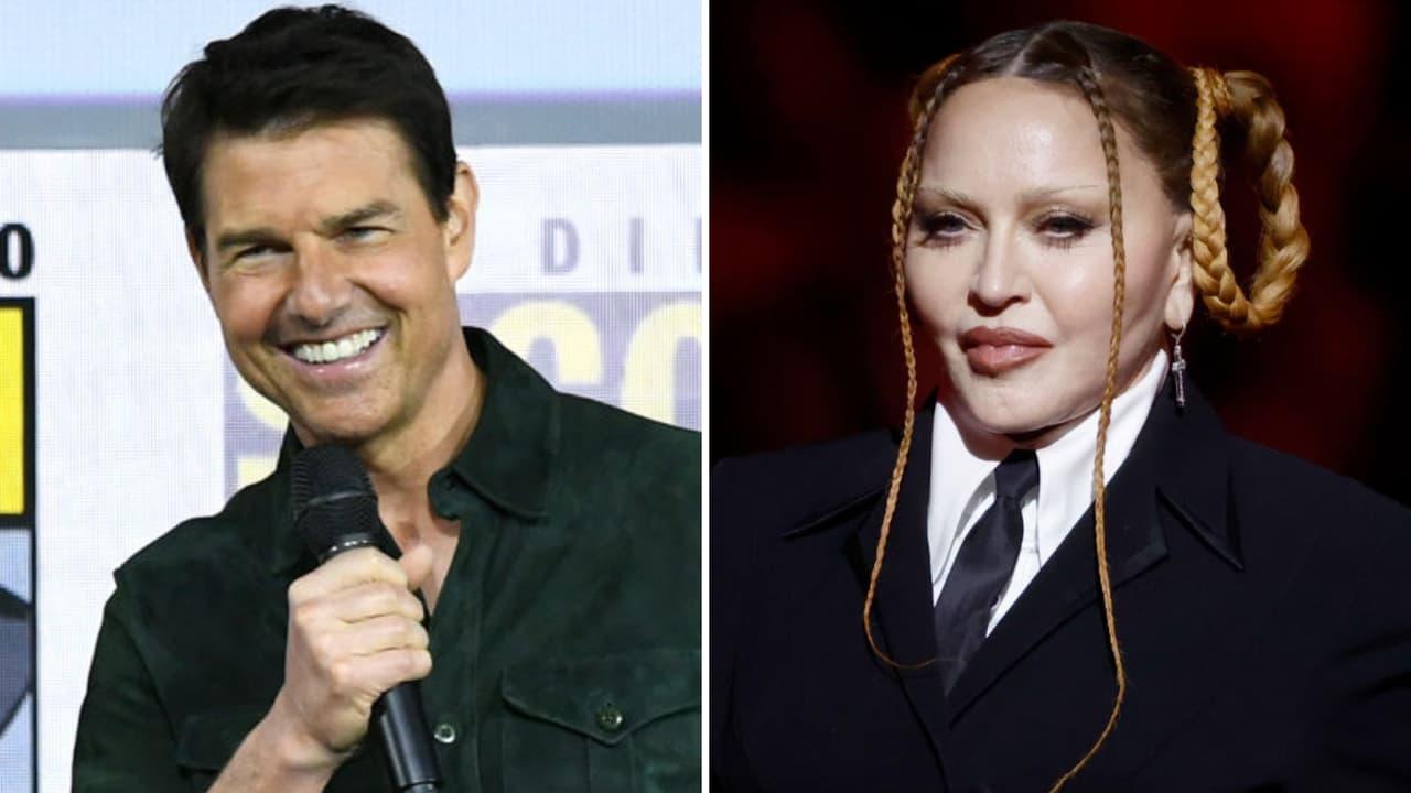 ¿Por qué algunos famosos quedan con la cara inflamada tras un retoque? Es el 'Pillow Face'