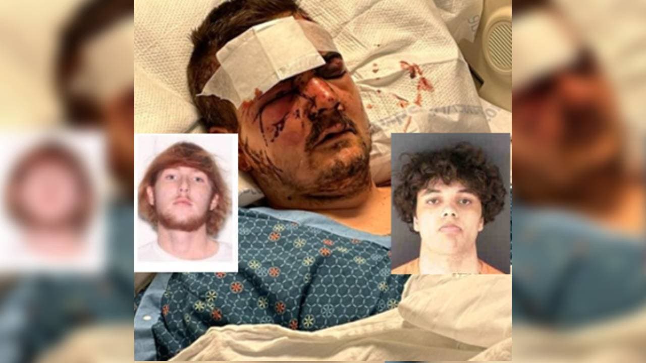 Detenido último sospechoso de golpear a un hombre hasta dejarlo inconsciente en Holmes Beach
