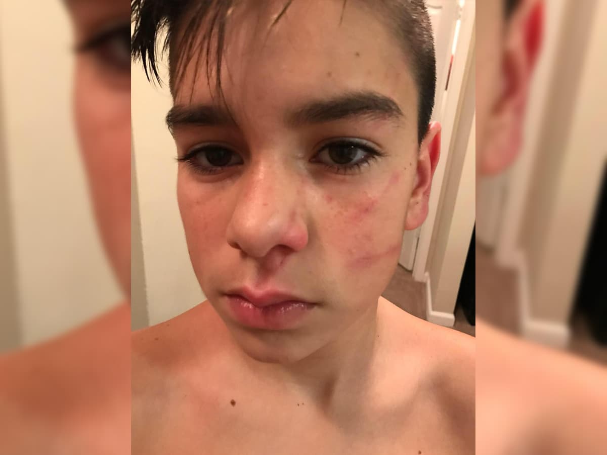 "Le dicen 'cállate la boca' cuando habla español": madre denuncia el acoso a su hijo en la escuela por ser hispano