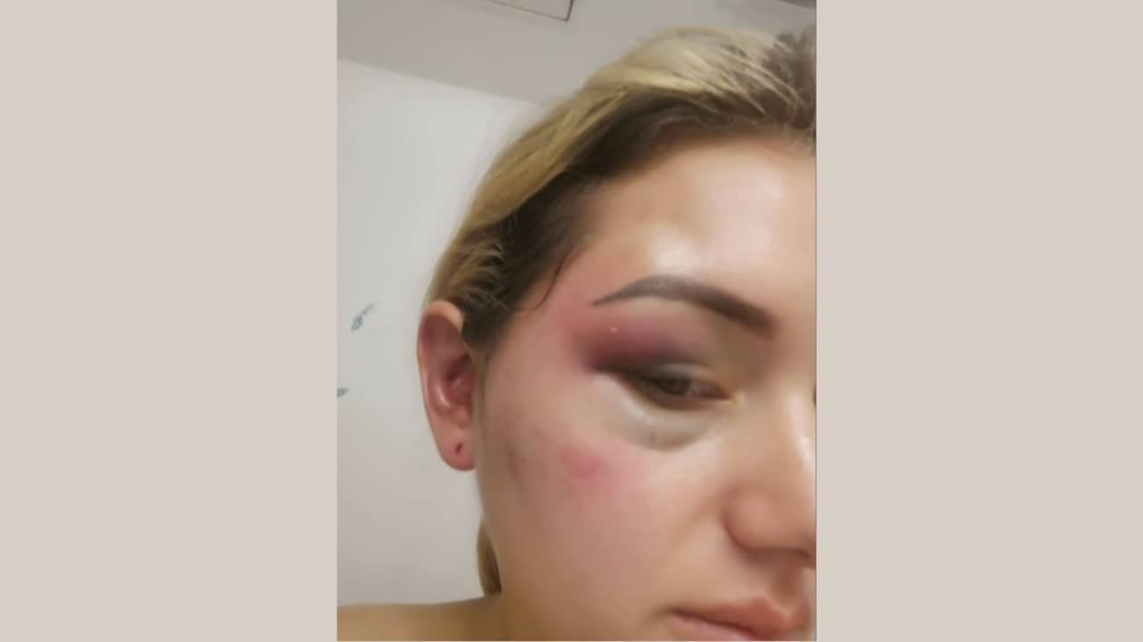 El atacante va a tener su próxima presentación en corte el 25 de septiembre. Andrea pide a las autoridades que se haga justicia, pues dice que tiene mucho miedo, además de que para ella es un peligro que este hombre ande suelto.
<br>