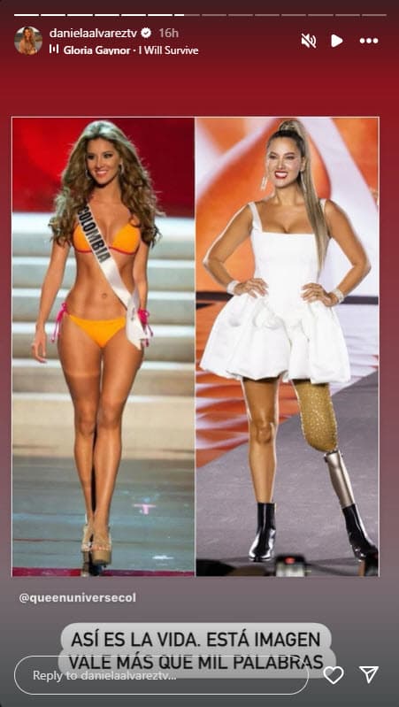 Daniella Álvarez antes y después de la amputación.