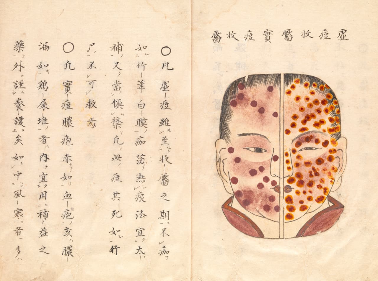 <b>Epidemia de viruela (735-737).</b> Mató entre el 33% y el 60% de la población de Japón, el brote más grave que haya afectado a este país en su historia. La mayoría de los afectados fueron los niños y muchos libros médicos japoneses de la época incluían las instrucciones para proteger a los pequeños de la enfermedad.