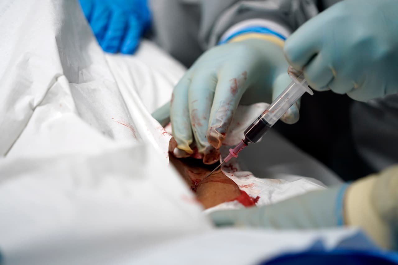 Las hospitalizaciones por covid-19 en Texas se han más que duplicado en las últimas semanas y las autoridades informan que en promedio hay más de cuatro veces más casos por día que hace un mes. En la fotografía un detalle del procedimiento médico a un paciente de covid-19 en el Centro Médico United Memorial.