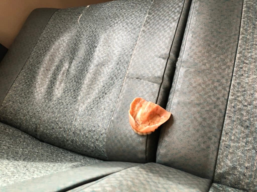 Historias del BART: la dentadura olvidada que se volvió viral