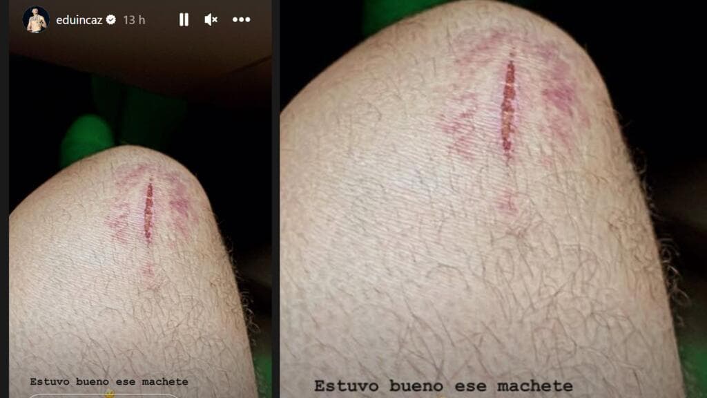 Eduin Caz ha sufrido hasta machetazos