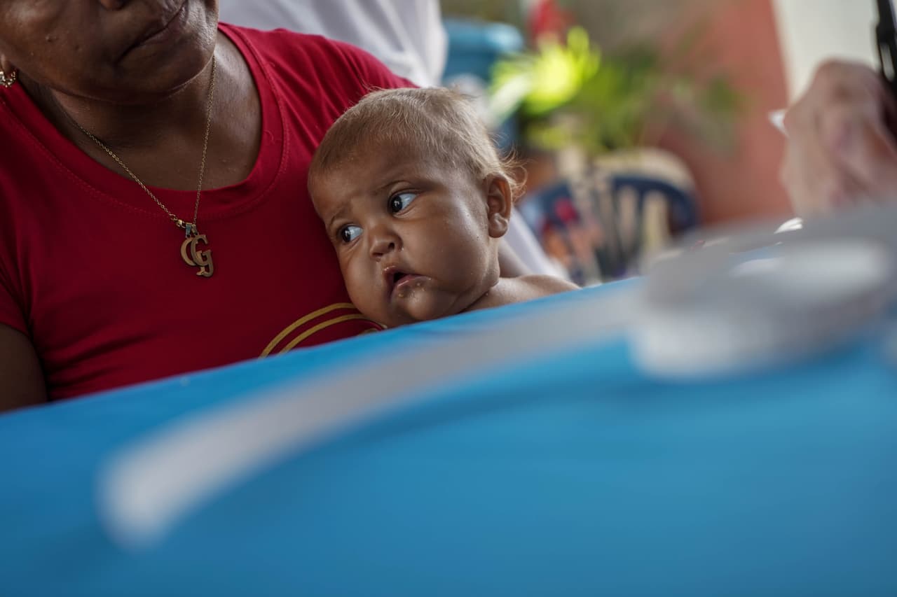 Uno de los casos que hallaron fue el de Jendriannys, una bebé de un año que presentaba hinchazón, surcos en la piel y pérdida de pigmentación en el cabello.