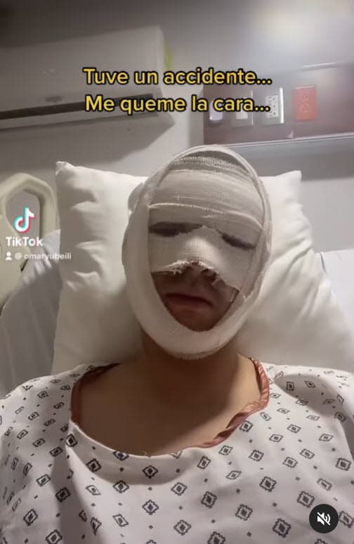 Dio a conocer que se quemó la cara y agradeció los mensajes de aliento que estaba recibiendo.
<br>
